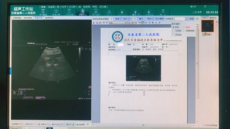 备孕检查甲状腺功能，标准解读与注意事项
